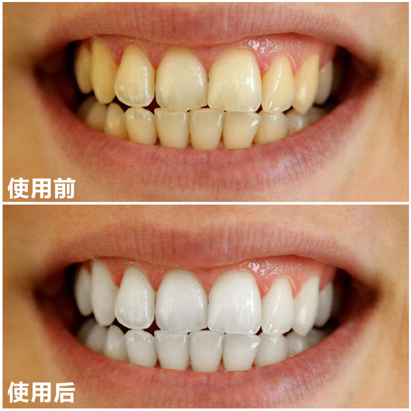 漱口水生产：探索背后的秘密